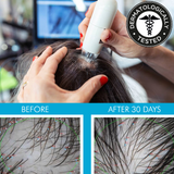 Laser Light Vibration Brush Therapy + Hair Follicle Stimulator Formula + Microneedling Hair Device