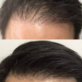 Hair Follicle Stimulating Formula - Hair Regrowth Activator