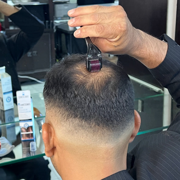 Step 2: HairCubed Microneedling Roller